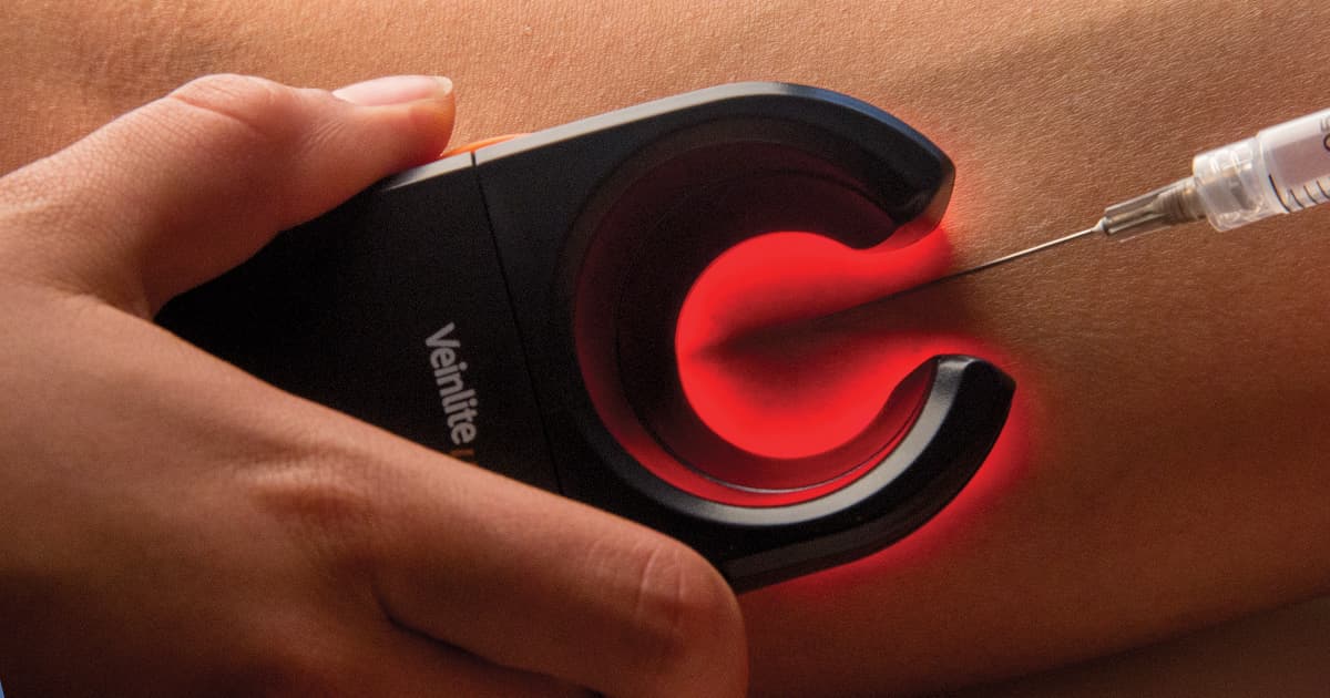 NIR vs. Ultrasound vs. Transillumination for Vein Access