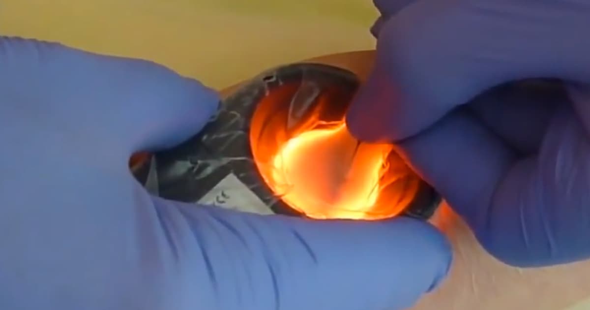 Is Seeing the Vein Enough for Vein Access? What Makes Veinlite Products So Effective?