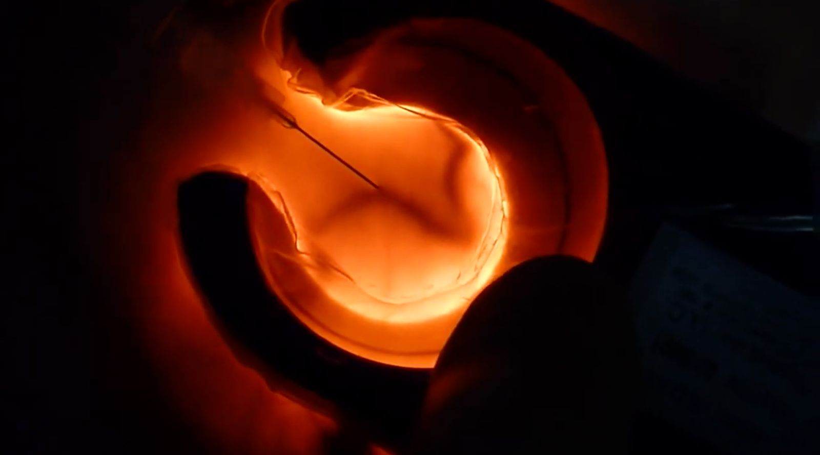 Load video: See Veinlite in action. Easily Identify and access veins.