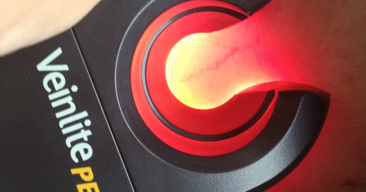 Veinlite PEDI® Proven Effective in Randomized Controlled Trial